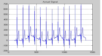Fig. 3 Input  Signal 
