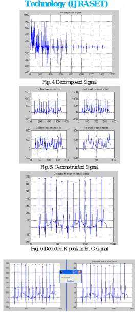 Fig. 4 Decomposed Signal 