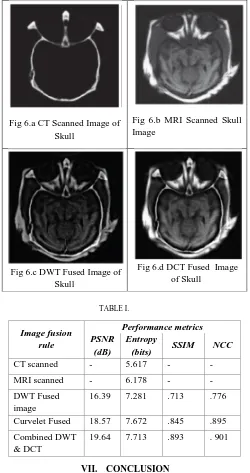 Fig 6.b MRI Scanned Skull Image  