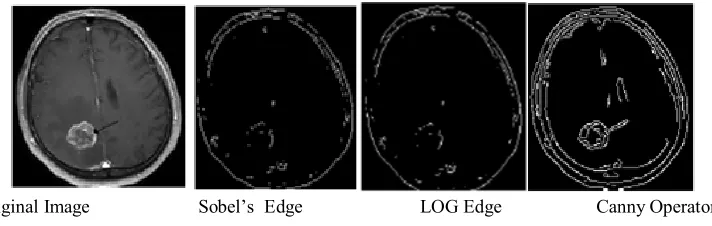 Fig. 4 Results of different operators [1] 