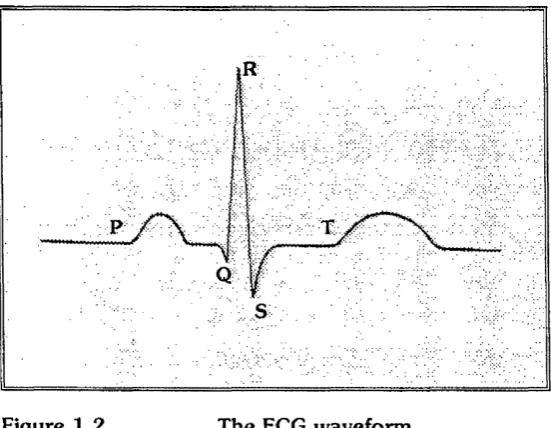 Figure 1.2The ECG waveform