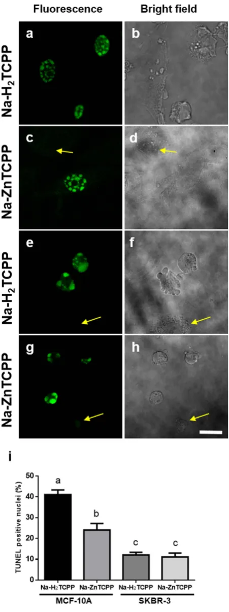 Figure 4. bright field microscope. Cells processed for TUNEL assay 5 h after irradiation and observed under fluorescence and (a,b) MCF-10A cells incubated with 4 μ M Na-H2TCPP