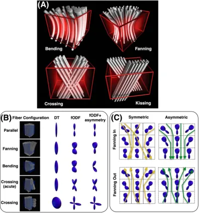 FIGURE 2A, Examples of complex fiber patterns that can result in very similar withinTournier et al‐voxel dMRI signals