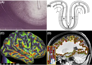 FIGURE 3A, A myelinet alat the gyral crowns (region C). C, Expected gyral bias based on estimated surfaces and cortical thickness