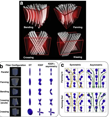 Figure 2. a) Examples of complex fibre patterns that can result to very similar 