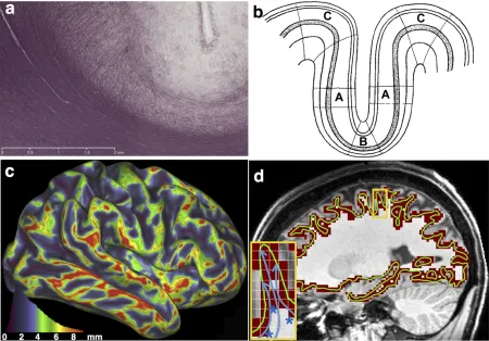 Figure 3. a) A myelin-stained slice showing fiber patterns in the cingulate 