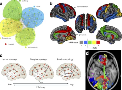 Figure 6. Characteristic network properties of brain graphs. a) Brain graphs are modular networks