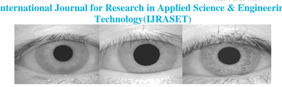 Fig 3- Sample images for one person from CASIA iris