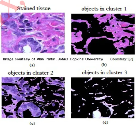 Fig. 1 An example of  image segmentation of an image of a stained tissue (a) original image , (b),(c),(d) are segmented images 