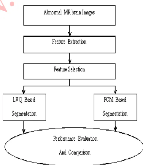 Fig. 3[2]: MRSI Brain Tumor Characterization for scheme 1