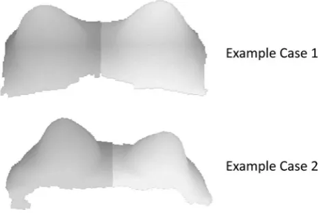 Fig. 6  Identified respectively) for the cases corresponding to (a) Fig. right and left breasts (grey and light grey areas, 3 and (b) Fig