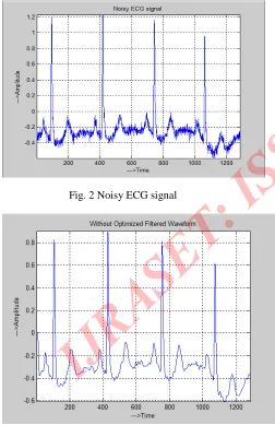 Fig. 2 Noisy ECG signal