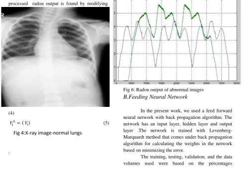 Fig 5: Radon output of Normal Images  