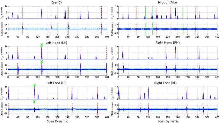 Figure 3: Decoding z-score Zm (top row) and EMG z-score trace (bottom row) during short task paradigm in For Peer Reviewand right foot (RF)