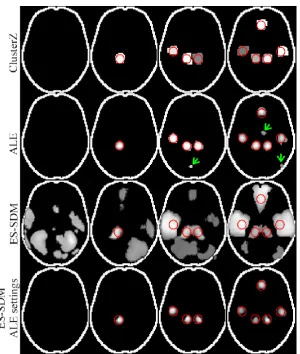 Figure 6. Typical results of numerical experiments with fixed numbers of clusters superimposed onto  ALE results, the arrows indicate small false clusters due to the use of voxel-wise FDR