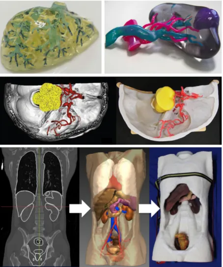 Fig. 6. Top left: dyed SLA liver [jetted torso phantom [63], top right: inkjetted kidney [72], centre: binder jetted cerebral aneurysm [69], bottom: binder80]