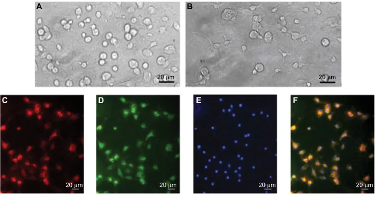 Figure 1 Micrographs of cultured dorsal spinal cord microglia cells (Notes:corresponding views of microglia cells labeled for Iba-1 (A–F)