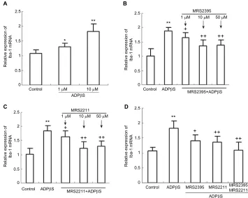 Figure 2 Real-time fluorescence quantitative polymerase chain reaction results show the expression of Iba-1 mRNA in cultured rat dorsal spinal cord microglia cells.(signiﬁcantly inhibited after pretreatment with MRS2395 (1, 10 and 50 μM) for 20 min