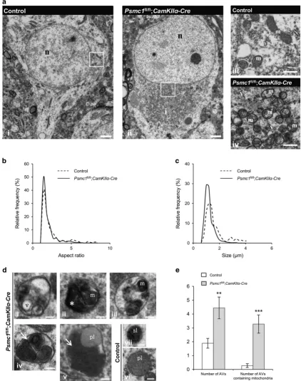 Figure 1Mitochondrial fragmentation and mitophagy in 26S proteasome-impaired neurons. (Psmc1(iresembling mitochondria undergoing autophagy are shown (iv and v; arrows)