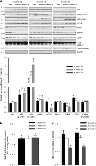 Figure 426S proteasome dysfunction induces selective autophagy, but continued dysfunction decreases essential autophagy proteins