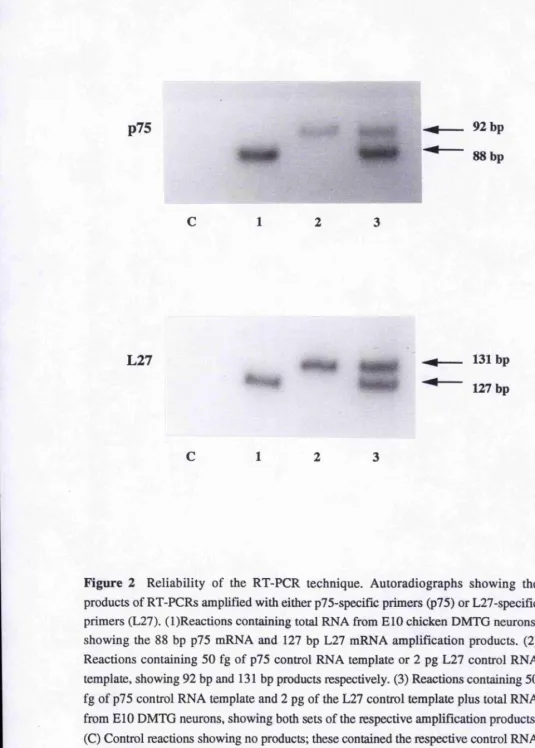 Figure 2 Reliability of the RT-PCR technique. Autoradiographs showing the 