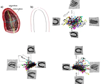 Fig. 8 The real example. Top left: the projection in 2D of the actual three-dimensional ventricular shape