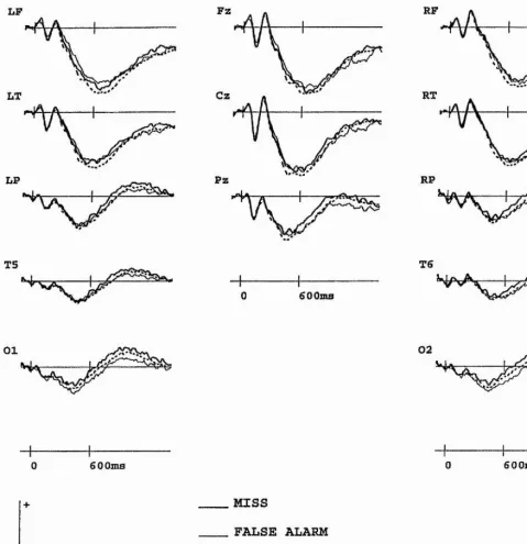 Figure 6.3 Grand average ERPs associated with the miss, false alarm, and correct 