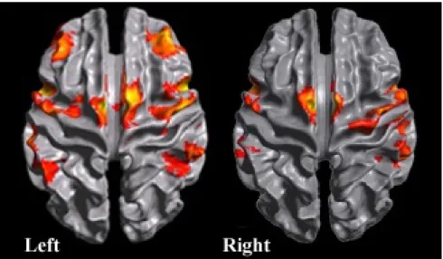 Figure 2.2: Differing areas of activation between imagined left and right hands squeez- squeez-ing a ball