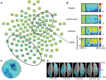 Figure 2 t-value maps (needle condition vs. cotton swab condition) of the 128-ch electroencephalography (eeg) system