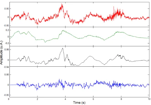 Figure 4.3: Top: EEG signal contaminated with EOG blinking artifacts - Middle &amp;