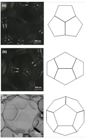 Figure 5 –Dodecahedron projection pattern of normal cells 