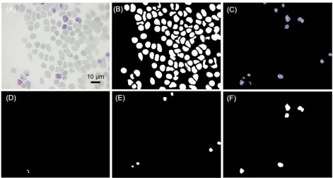 Fig 4, image-based cytometer equipped with 100X allowed us to reliably classify all the threespecific classification
