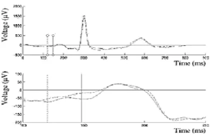 Figure (2): Process current drawing of the steps complicated in Biometric system. 