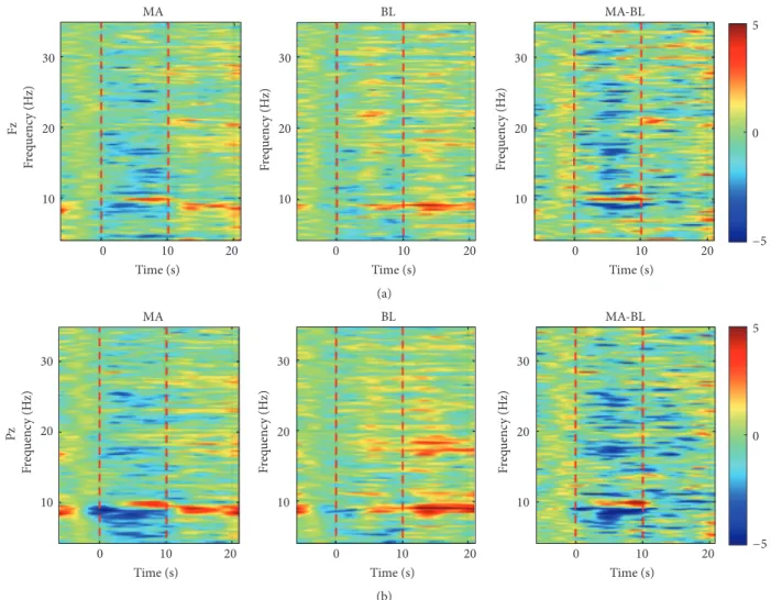 Figure 3: Grand average time-frequency analysis results for event-related (de)synchronization (ERD/ERS) in the frequency band of 4–35 Hz in frontal ((a) MA, BL, and MA-BL at Fz from left to right) and parietal areas ((b) MA, BL, and MA-BL at Pz from left t
