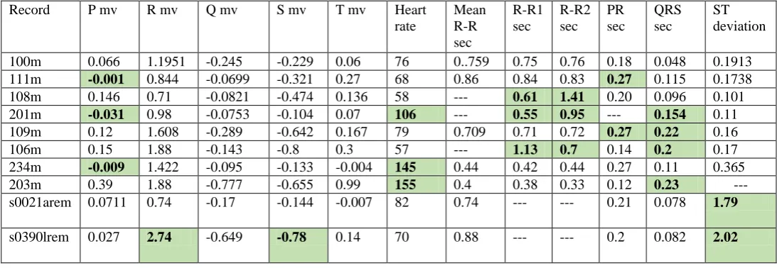 Figure (7c): detect QRS complex with their duration. 