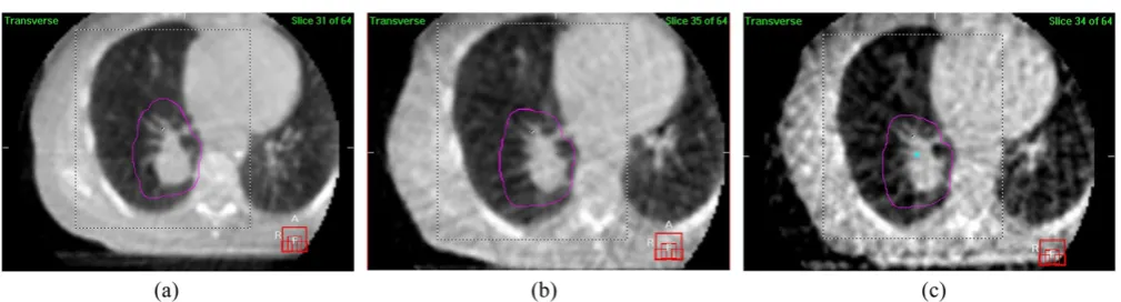 Table 1. Presets 1, 2 and 3 compared with a three-dimensional (3D) cone beam CT preset