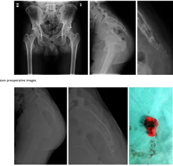 Figure 1 Partial excision preoperative images.