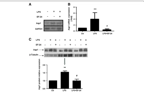 Figure 3 Expression of aquaporin-1 mRNA and protein in polymorphonuclear granulocytes is induced by lipopolysaccharide.(A)End-point PCR was performed on RNA isolated from PMNs, as above and analyzed on 2.5% agarose gel.analyzed by SDS-PAGE and immunoblotti