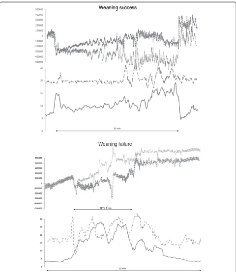 Figure 2 Electrical activity of the diaphragm (EAdimax), respiratory inductive plethysmography (RIP), and respiratory rate (RR) tracings(y-axes) over time (x-axis) of a success (number 6) and a failure patient (number 2) during a spontaneous breathing tria