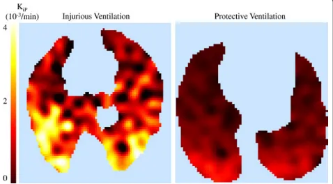 Figure 3 Single-slice images ofcomputed voxel-by-voxel using the Patlak method [31]) in one sheep from the protective ventilation group (right panel) and in one from theinjurious ventilation group (left panel)