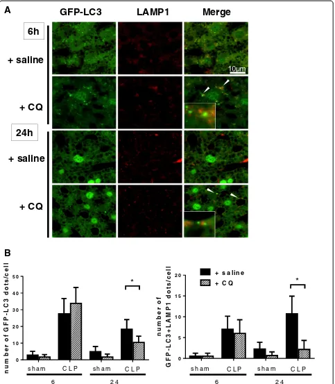 Figure 4 Blockade of the autophagic process by chloroquine. Green fluorescent protein- microtubule-associated protein light chain 3(GFP-LC3) transgenic mice were administered saline or chloroquine (CQ) (60 mg/kg intraperitoneally) at 1 h after CLP or sham 