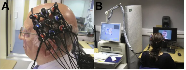 Fig. 1. fNIRS optode placement and experimental set-up. A) A Hitachi 3 � 3 optode array placed over the temporal brain regions of a CI recipient