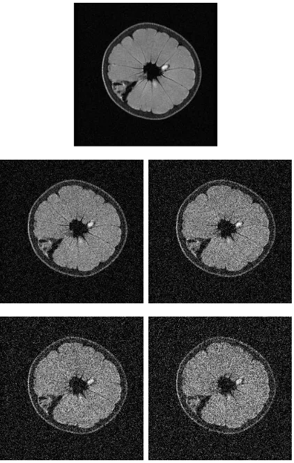 Figure 3:An example of the MRI data without and with noise of diﬀerent levels(0.01,0.02,0.03,0.04).