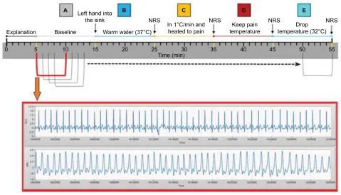 Figure 2 Experimental process.Notes: The upper panel shows experimental process. The lower panel shows the repeat window method, which had a base unit of 5 min and a delay time of 1 min