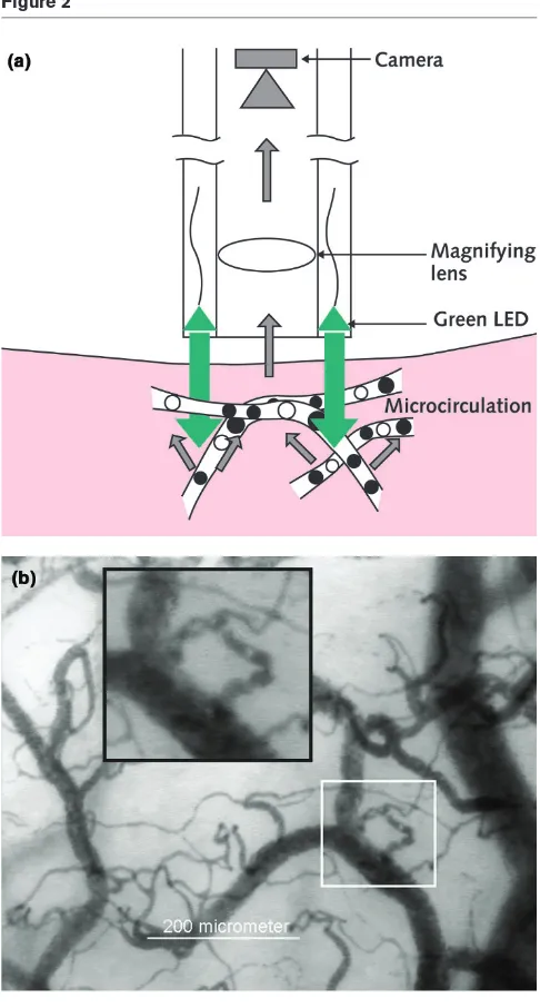 Figure 2(Fig. 2a; see www.sdfimaging.net for real-time movies). TheLEDs at the tip of the guide are optically isolated from the