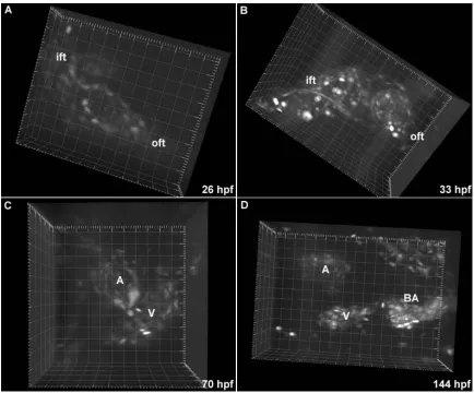 Figure 3.2. Heart morphogenesis in Tg(gata1:GFP) embryos. (A-D) Blood cells are fluorescently labeled, permitting visualization of blood flow and intracardiac volumes