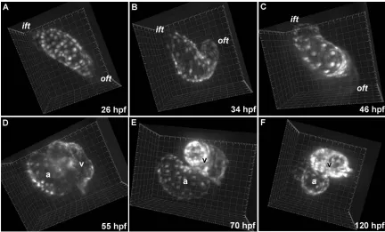 Figure 3.3 Heart morphogenesis in Tg(cmlc2:GFP) embryos. Fluorescently labeled myocardium permits visualization of cardiogenesis and contractile mechanics