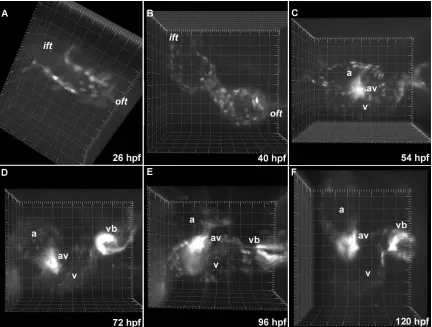 Figure 3.4. Heart morphogenesis in Tg(tie2:GFP) embryos. (A) A single layer of endothelial cells lines the 26 hpf heart tube