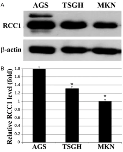 Figure 2. Protein expression levels of RCC1 analyzed in three different gastric cancer cell lines by west-ern blotting