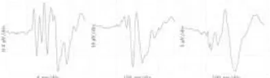 Fig. 1: Various morphologies of evoked potentials. The  duration, amplitude and morphology differ considerably from potential to potential